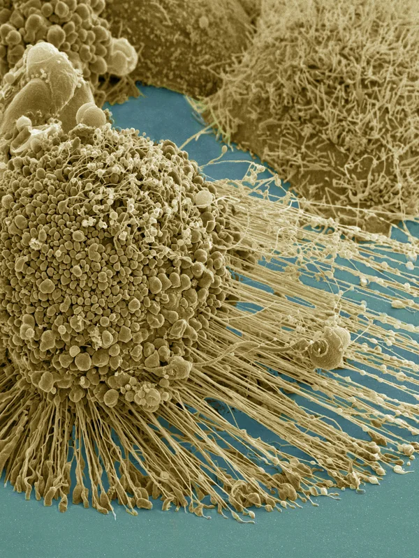 Medical CAT Scan Commercialization