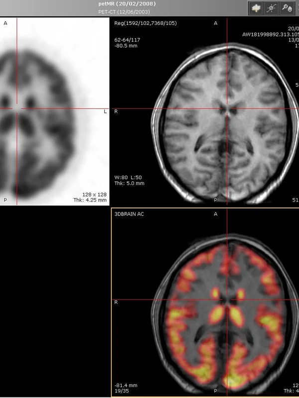 Medical MRI Scanner Commercial Use