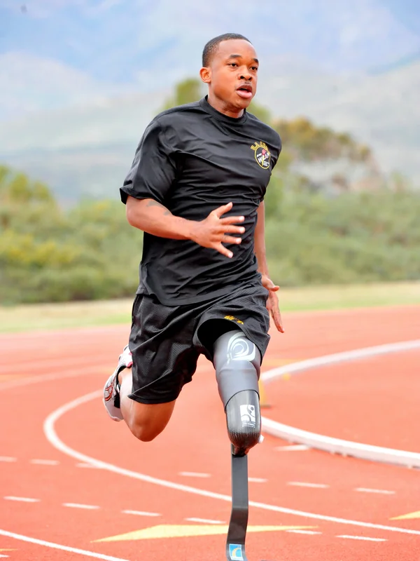 Advanced Prosthetic Limb Control