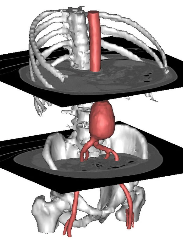 Medical 3D Imaging Software