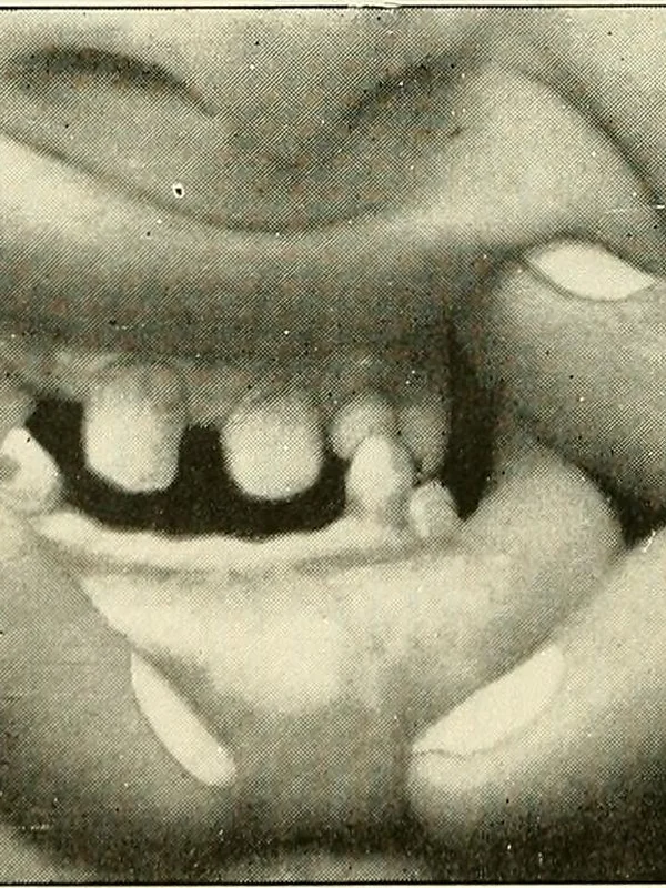 Medical AI Diagnostics