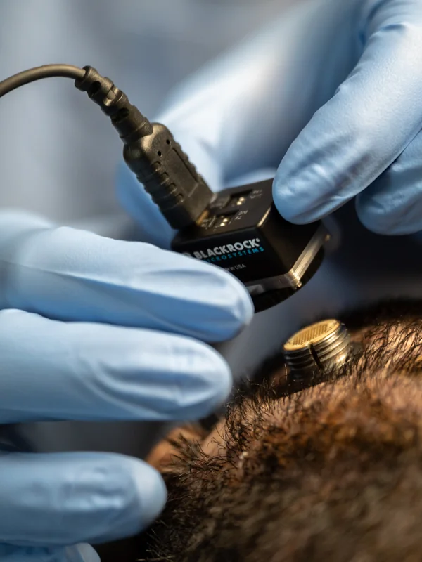 Brain-Computer Interface Trials