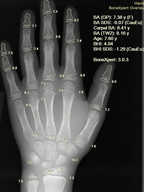 Personal Health AI Monitors